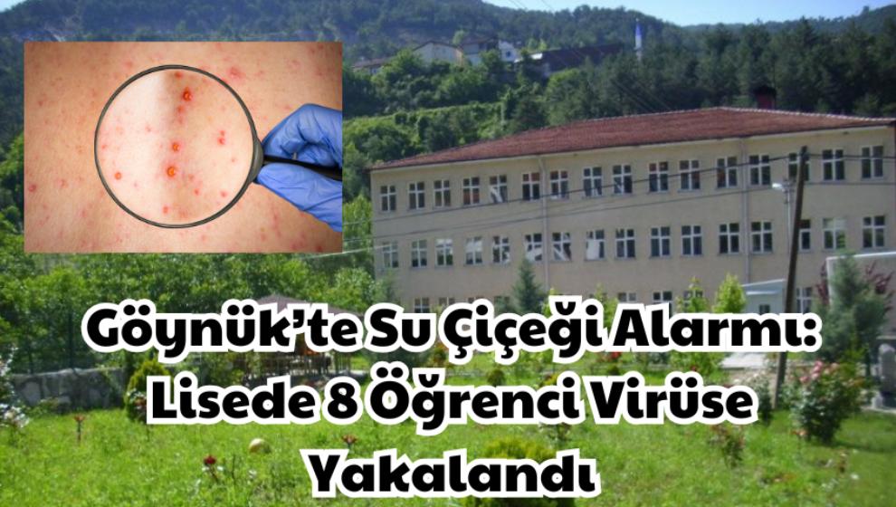Göynük’te Su Çiçeği Alarmı: Lisede 8 Öğrenci Virüse Yakalandı